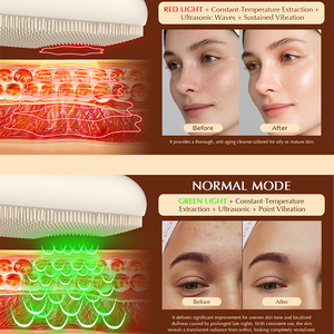 Brosse nettoyante exfoliante pour le visage en silicone chauffante, version améliorée, compatible <span class=keywords><strong>antibactérien</strong></span> - Product Image 2