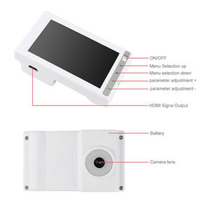 Visualizador de Venas Portátil con Pantalla LCD, Infrarrojo, para Uso Veterinario y Humano, Detector de Venas Facial y Corporal - Product Image 5