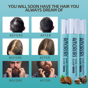 Suero Vegano Orgánico de Marca Privada Personalizada para el Tratamiento de la Calvicie, Aceite Herbal Anticaída que Estimula el Crecimiento del Cabello - Product Image 5