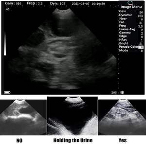 Alat USG Veteriner Portabel GOYOJO untuk Kehamilan dengan <span class=keywords><strong>Probe</strong></span> Sektor Mekanis untuk Domba dan Babi - Product Image 2