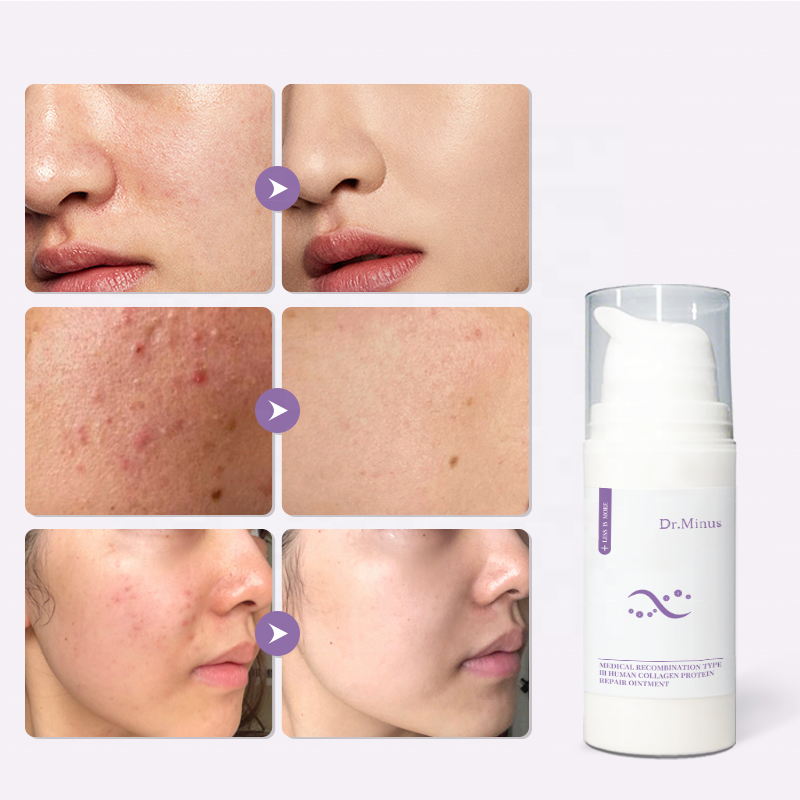 Medical-Grade Recombinant Collagen Ointment 30g Fragrance-Free Healing Hydration Barrier Repair Anti-Aging Post-Procedure