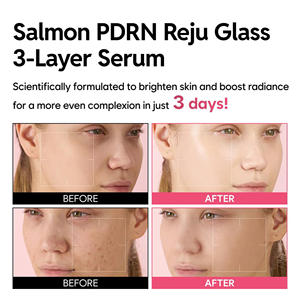 Aangepaste drielaagse Niacinamide Zalm DNA PDRN Anti-verouderings serum met poriënverkleining, whitening en olieparels microcapsules gezichtsessence - Product Image 6