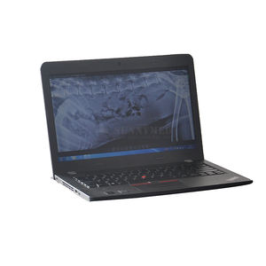 جهاز الأشعة الرقمية SY-D019BDR_<span class=keywords><strong>Vet</strong></span> للطبيب البيطري بتردد عالٍ جهاز الأشعة الرقمية <span class=keywords><strong>X</strong></span> للحيوانات بسعر مناسب - Product Image 4