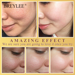 BREYLEE beurre De Karité nourrissant hydratant lotion pour le visage soins de la peau crème livraison gratuite - Product Image 4