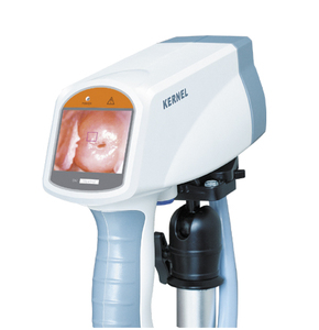 Thiết bị kiểm tra âm đạo colposcope kỹ thuật số với phần mềm KN-2200 bệnh viện <span class=keywords><strong>Video</strong></span> nội soi phụ khoa colposcope - Product Image 5