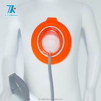 Cloches à vide à double protection pour le traitement du pectus excavatum (poitrine encastrée) sur table d'opération