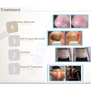 Láser de Diodo de Doble Longitud de Onda 980nm 1470nm para Terapia Láser Endovenosa EVLT, Eliminación Vascular y Lipólisis Láser para Disolver Grasa - Product Image 4
