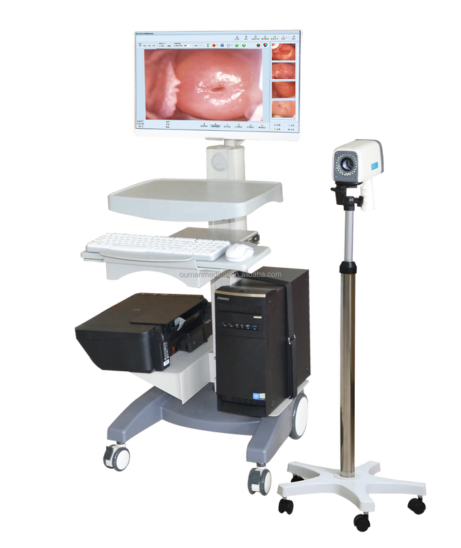 Gynecology HD Digital Video Colposcope Gynecological