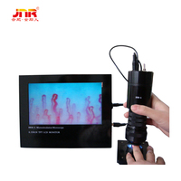 High-Resolution Nailfold Microcirculation Microscope for Medical Diagnostics