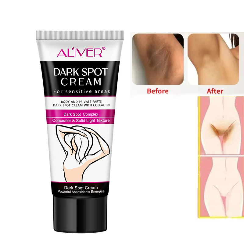 Weiblicher Körper Private Part White ning Cream Intensive Bleaching Achsel aufhellung creme für empfindliche Bereiche