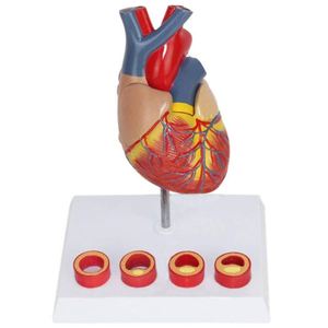 Modelo de corazón KyrenMed corazón con modelo de trombo - Product Image 1