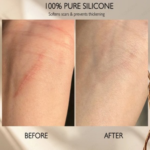 Groothandel Litteken Genezende Crème Huid Reparatie Litteken Siliconen Crème Custom Geur Maken Littekens Zachter - Product Image 3