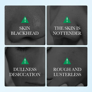 Mascarilla <span class=keywords><strong>facial</strong></span> purificante de carbón <span class=keywords><strong>activado</strong></span> Darry Love, <span class=keywords><strong>Limpieza</strong></span> Profunda, eliminación de espinillas, suavizante para pieles tiernas - Product Image 2