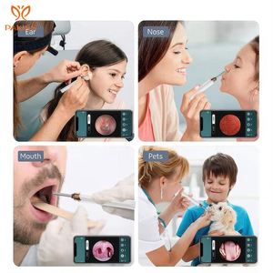 Otoscopio con Cámara para Bebés Pakiss, Kit de Extracción de Cera del Oído con Microsucción al Vacío, Portátil para Uso Doméstico - Product Image 4
