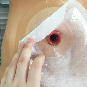 แหวนกั้นรูท้องแบบใช้แล้วทิ้งสำหรับถุงใส่ของเสียทางลำไส้ใหญ่ - Product Image 6