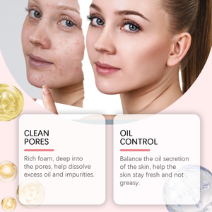 OUHOE Espuma de ácido salicílico Hidratante suave Control de aceite Limpieza de la piel facial Limpiador de poros delicado - Product Image 3