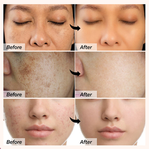 Private Label Hautaufhellendes Kojisäure-Serum, Stark Aufhellende Gesichtscreme, Bleichseife, Körperlotion, Hautöl, Hautpflegeset - Product Image 5