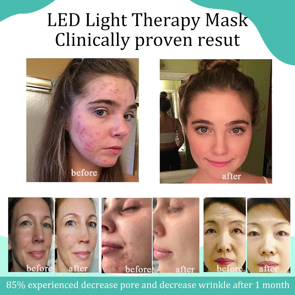 Máscara popular de LED Currentbody para relaxar a pele, acelerar o crescimento e a cura das células da pele, cromoterapia, máscara de terapia de luz facial LED