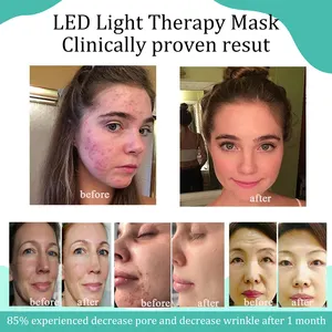 beliebte Currentbody LED-Maske Haut entspannen beschleunigen Wachstum und Heilung von Hautzellen Chromotherapie LED-Gesichtslicht-Therapie-Maske
