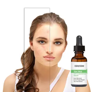 OEM/ODM Factory Tea Tree Serum Acne Pimple Removal Treatment Acne Anti Serum Skin Care