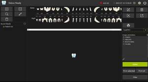 Cảm biến <span class=keywords><strong>RVG</strong></span> nha khoa kỹ thuật số USB IRay Pluto 0001X/ Pluto 0002X Hệ thống chụp ảnh kỹ thuật số CMOS APS - Product Image 5