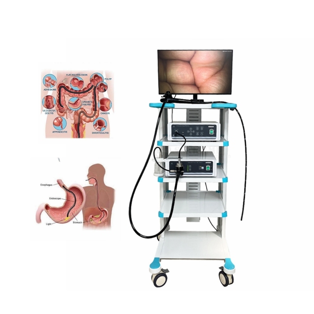 SY-PGC048 Ent Surgery Surgical Navigation System Medical Full HD Laparoscopy Tower for Rigid Endoscopy