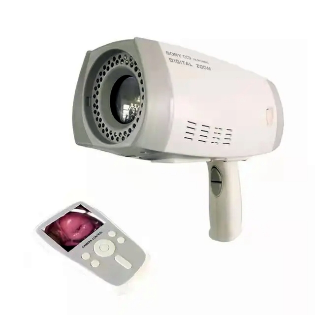 Portable Digital Colposcope Endoscope Camera Electronic Handheld Colposcope for Gynecology