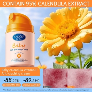 <span class=keywords><strong>Crema</strong></span> <span class=keywords><strong>Lenitiva</strong></span> Delicata Anti-Screpolature SADOER per Bambine con <span class=keywords><strong>Calendula</strong></span> e Vitamina E, per Tutti i Tipi di Pelle, Versione Internazionale - Product Image 3
