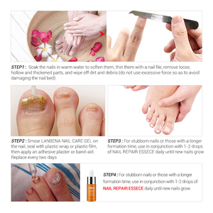 LANBENA - Gel Reparador de Uñas para el Tratamiento de Hongos en las Uñas, Marca Privada - Product Image 5