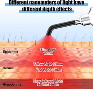 <span class=keywords><strong>ปาก</strong></span>กาบำบัดด้วยแสงสีแดงแบบกำหนดเอง 460~900 นาโนเมตร อุปกรณ์รักษา<span class=keywords><strong>แผล</strong></span>ร้อนในสำหรับปาก จมูก หู และดวงตา - Product Image 5