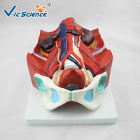 Modelo Anatómico del Sistema Urinario Humano, Modelo de Riñón, Uréter, Vejiga y Uretra para Enseñanza Médica en Urología, CE/ISO/ROHS/CNAS