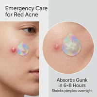 Patch anti-acné WaterDropCare, patch hydrocolloïde en forme de goutte d'eau pour une guérison rapide, design invisible, fabrication OEM/ODM