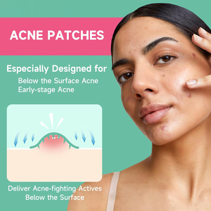 แผ่นแปะสิวไมโครดาร์ท 36 ชิ้น สำหรับ<span class=keywords><strong>รอย</strong></span><span class=keywords><strong>สิว</strong></span>ฝังลึก ผสมกรดซาลิไซลิกและมาเดคโคไซด์ - Product Image 2