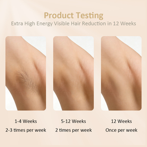 <span class=keywords><strong>Épilateur</strong></span> laser IPL portable pour le visage, le corps, les jambes, le bikini et les lèvres, 8 niveaux d'intensité, rajeunissement de la peau, <span class=keywords><strong>épilateur</strong></span> IPL pour usage domestique - Product Image 5