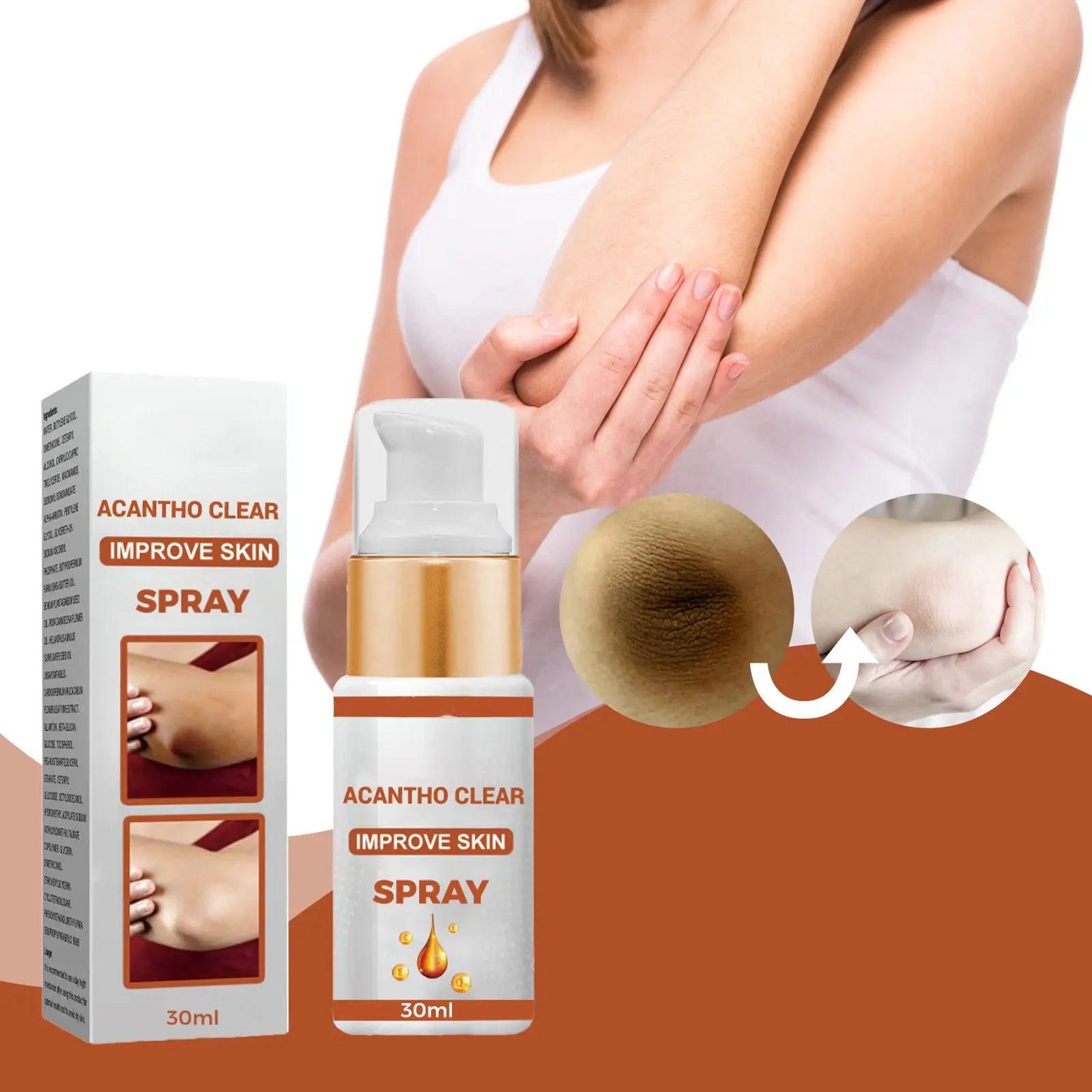 factory price acantho clear therapy spray elbow and knee joints skin brightening care skin improvement