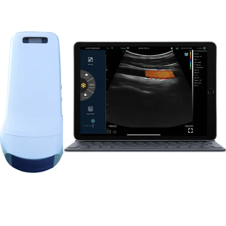 KONTED 3 in 1 Wireless Ultrasound Probe Color Doppler Ultrasound Scanner for whole-body examination