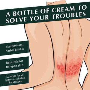 Crème Réparatrice Peau Atopique Mains et Pieds – Traitement <span class=keywords><strong>Antifongique</strong></span> Externe – Marque Privée – Soulagement Rapide des Démangeaisons Cutanées et du Psoriasis - Product Image 6
