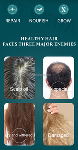 ¡NUEVO! Cuidado del cabello Nourish Leave in Hair Tratamiento Suero OTVENA Essential <span class=keywords><strong>Spray</strong></span> - Product Image 4