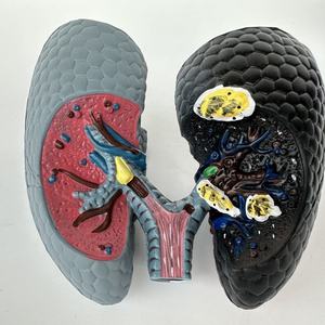 Modelo de Comparación de Ciencias Médicas: Pulmones Humanos Fumadores, Patología, Modelo de Enfermedad, Modelo de Enfermedad Orgánica, Modelo Antidrogas - Product Image 4