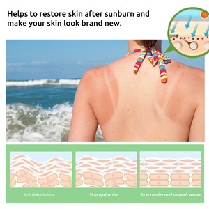 Loción de Aloe Vera calmante aclarante orgánico para el alivio de las quemaduras solares faciales después del bronceado Loción calmante para la piel - Product Image 5