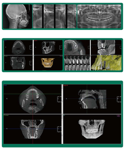 Kỹ Thuật Số nha khoa opg toàn cảnh 3D x Ray tomographic hệ thống nha khoa kỹ thuật số cbct 3D toàn cảnh nha khoa cephalometric x Ray máy - Product Image 3
