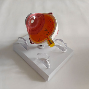 Modelo Anatómico Patológico del Ojo Humano, Modelo de Exhibición de Enfermedades de la Córnea para Enseñanza Médica - Product Image 3