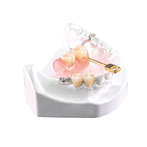 Accessori di precisione tecnico odontoiatrico di alta qualità MK1 - Product Image 6