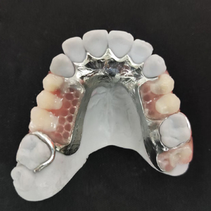 Marco de metal completo <span class=keywords><strong>superior</strong></span> e inferior con <span class=keywords><strong>dentadura</strong></span> <span class=keywords><strong>parcial</strong></span> acrílica extraíble - Product Image 3