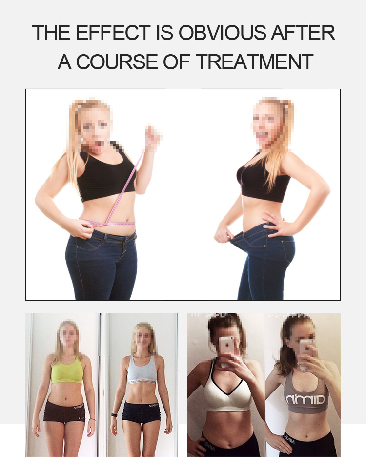 Bieir vela vacuum roller RF cavitation fat burning slimming machine beauty salon SPA equipment