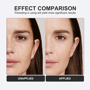 Mẫu miễn phí mặt kem làm trắng sáng THẬM CHÍ Toning txa mụn Corrector Remover đốm đen kem - Product Image 6