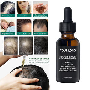 Black Castor <b>Rosemary</b> Nourishing Anti-Hair Loss Silicone-Free Hair Care <b>Oil</b> 60ml Suitable for All Hair Types - Product Image 5