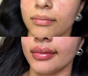 Voluminizador de Labios Extremo en Tubo Exprimible, Hidratante de Larga Duración, Cuidado Labial de Marca Privada - Product Image 6