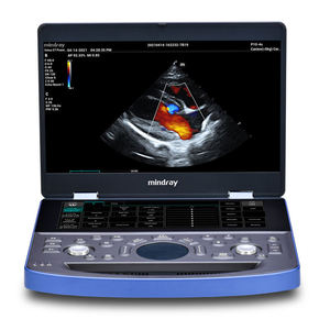 Appareil d'échographie portable vétérinaire Mindray Vetus E7 pour bétail, scanner d'échographie vétérinaire, sonde convexe pour la gestation - Product Image 1