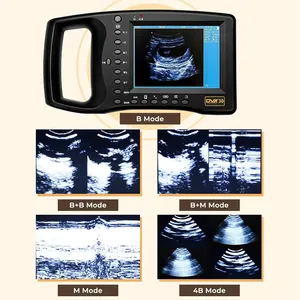 Appareil d'échographie vétérinaire portable pour la gestation des chevaux, des vaches et des animaux de grande taille - Product Image 5